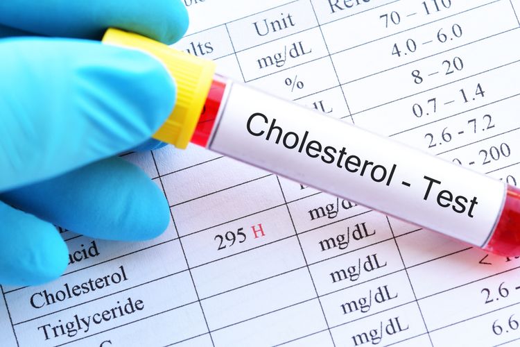 High Cholesterol Foods to Avoid: A Guide to Protecting Your Heart Health