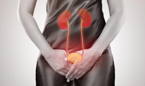 86b2e371-770b-4345-8e1d-ecac5f5463eb_169