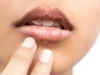 Stop Jilati! Begini Cara Paling Efektif Atasi Bibir Kering