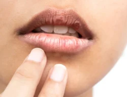 Stop Jilati! Begini Cara Paling Efektif Atasi Bibir Kering